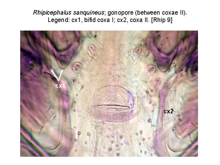 Rhipicephalus sanquineus; gonopore (between coxae II). Legend: cx 1, bifid coxa I; cx 2,