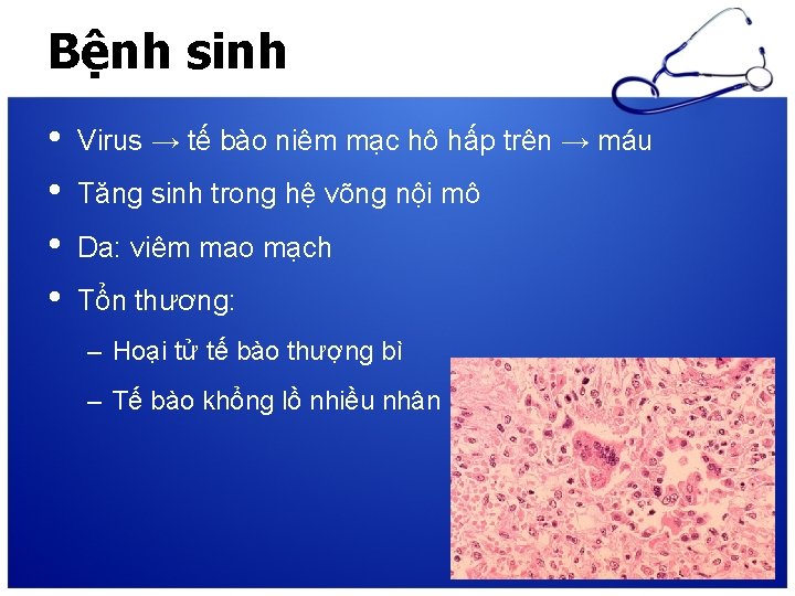 Bệnh sinh • • Virus → tế bào niêm mạc hô hấp trên →