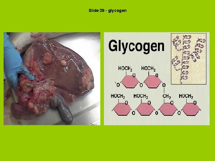 Slide 39 - glycogen 