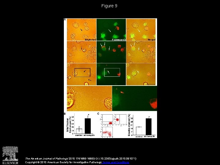 Figure 9 The American Journal of Pathology 2010 1761685 -1695 DOI: (10. 2353/ajpath. 2010.