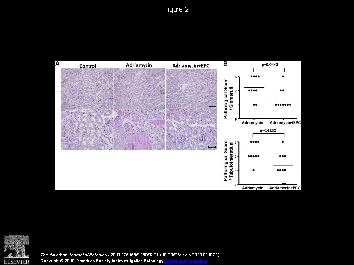 Figure 2 The American Journal of Pathology 2010 1761685 -1695 DOI: (10. 2353/ajpath. 2010.