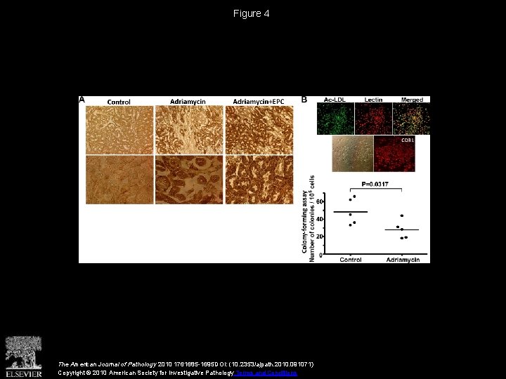 Figure 4 The American Journal of Pathology 2010 1761685 -1695 DOI: (10. 2353/ajpath. 2010.