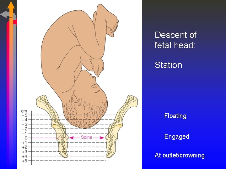 Descent of fetal head: Station Floating Engaged At outlet/crowning 