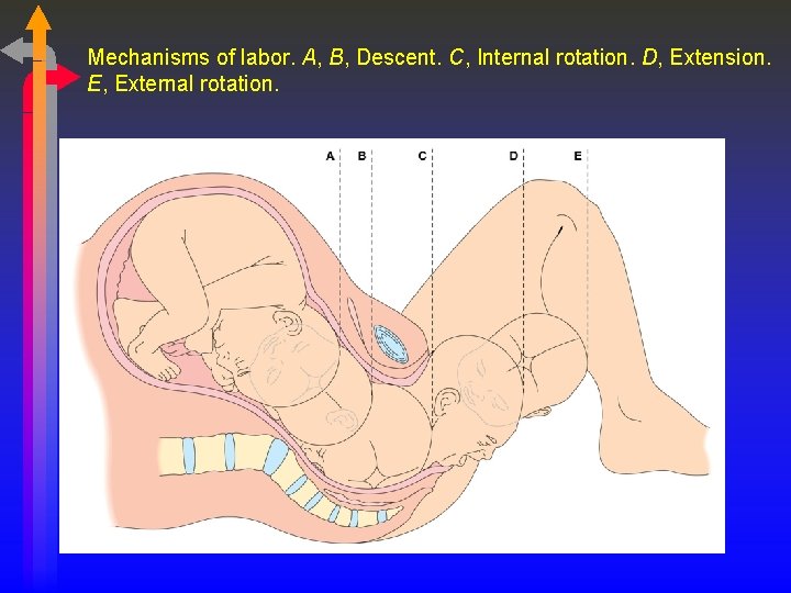 Mechanisms of labor. A, B, Descent. C, Internal rotation. D, Extension. E, External rotation.