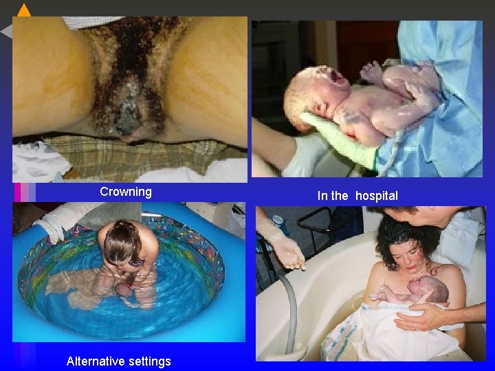 Crowning Alternative settings In the hospital 