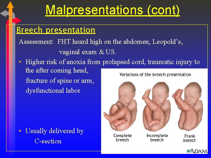 Malpresentations (cont) • Breech presentation Assessment: FHT heard high on the abdomen, Leopold’s, vaginal