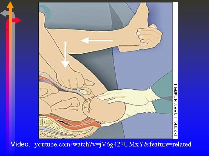 Video: youtube. com/watch? v=j. V 6 g 427 UMx. Y&feature=related 