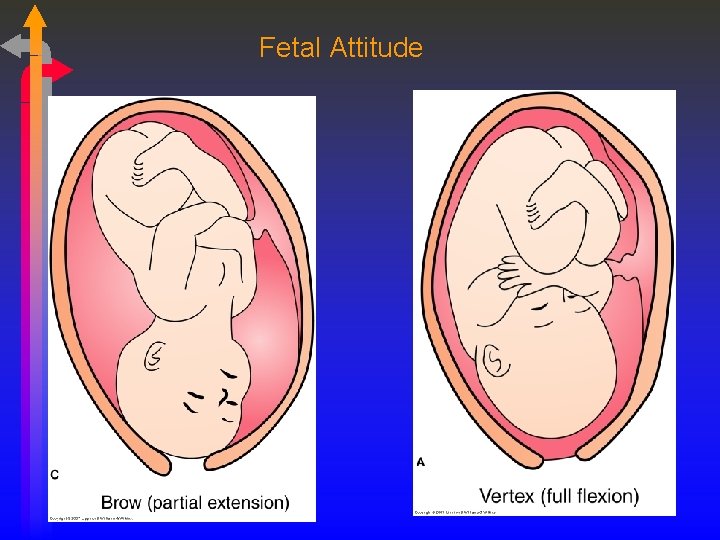 Fetal Attitude 