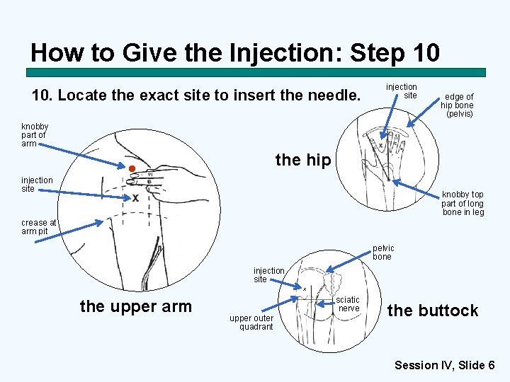 How to Give the Injection: Step 10 10. Locate the exact site to insert