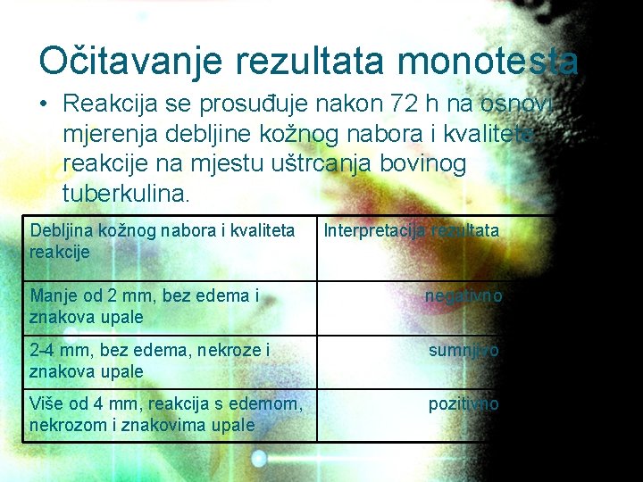 Očitavanje rezultata monotesta • Reakcija se prosuđuje nakon 72 h na osnovi mjerenja debljine