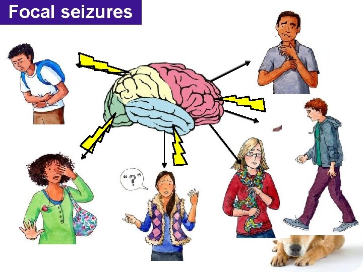 Focal seizures 