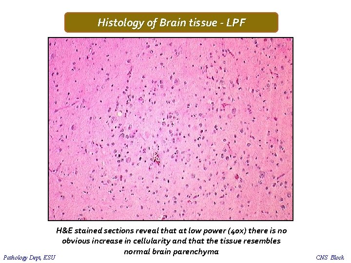 Histology of Brain tissue - LPF Pathology Dept, KSU H&E stained sections reveal that