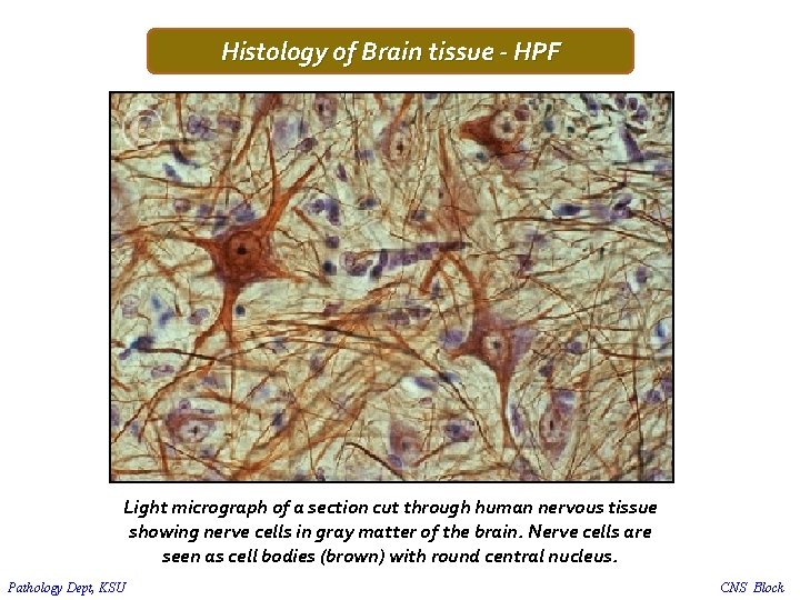 Histology of Brain tissue - HPF Light micrograph of a section cut through human