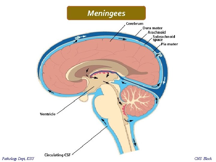 Meningees Pathology Dept, KSU CNS Block 