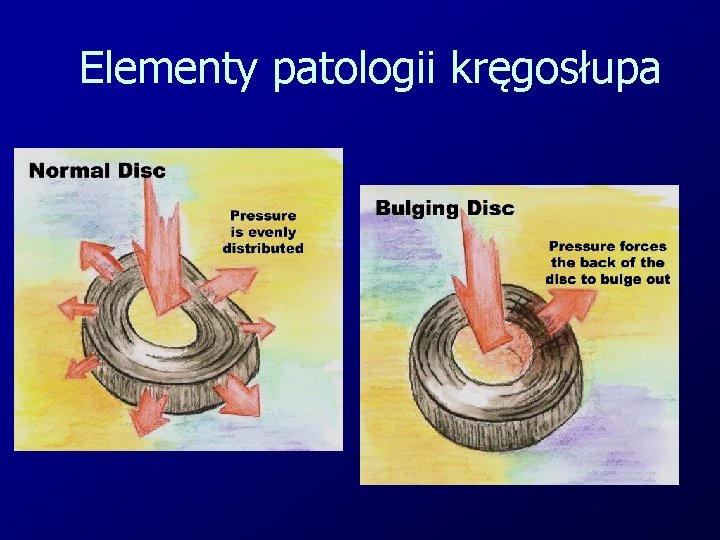 Elementy patologii kręgosłupa 