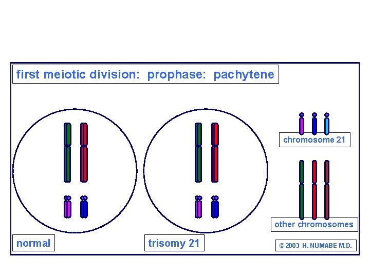 first meiotic division: prophase: pachytene chromosome 21 other chromosomes normal trisomy 21 © 2003