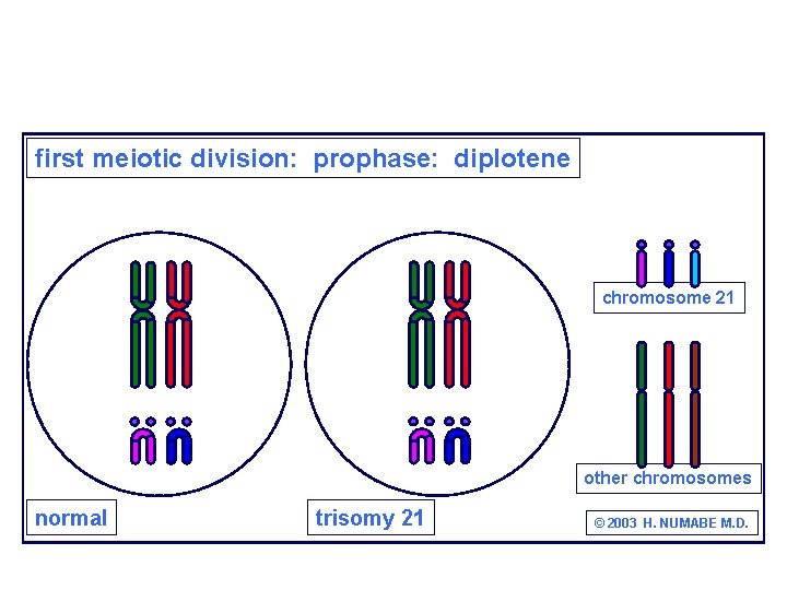 first meiotic division: prophase: diplotene chromosome 21 other chromosomes normal trisomy 21 © 2003