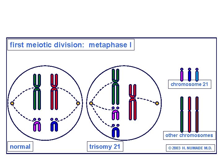 first meiotic division: metaphase I chromosome 21 other chromosomes normal trisomy 21 © 2003