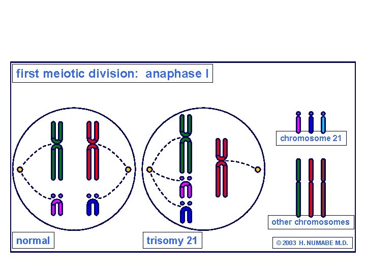 first meiotic division: anaphase I chromosome 21 other chromosomes normal trisomy 21 © 2003