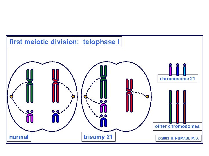 first meiotic division: telophase I chromosome 21 other chromosomes normal trisomy 21 © 2003