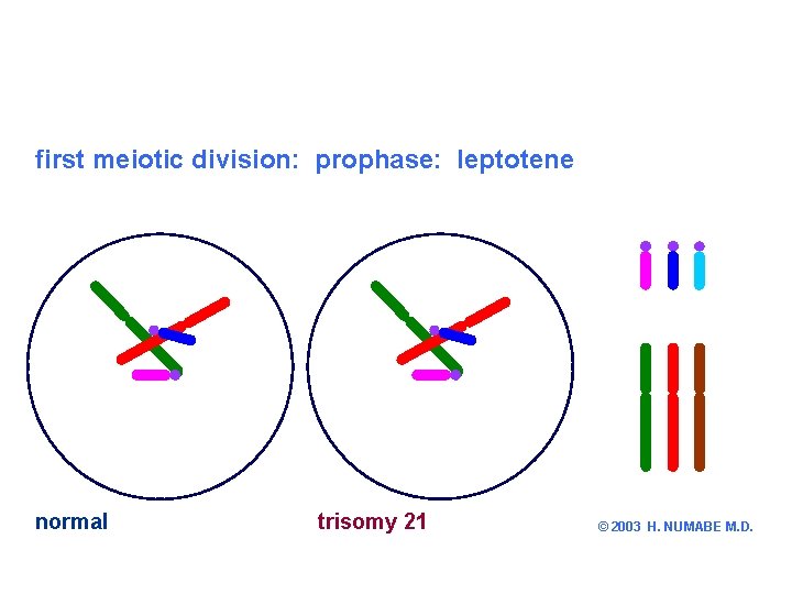 first meiotic division: prophase: leptotene chromosome 21 other chromosomes normal trisomy 21 © 2003