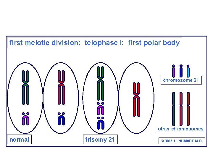 first meiotic division: telophase I: first polar body chromosome 21 other chromosomes normal trisomy