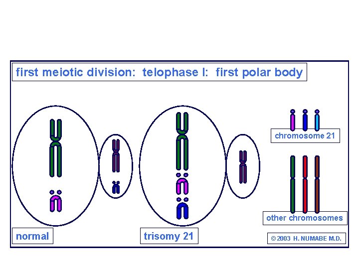 first meiotic division: telophase I: first polar body chromosome 21 other chromosomes normal trisomy