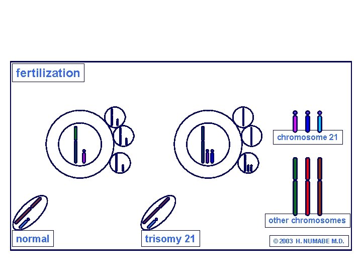fertilization chromosome 21 other chromosomes normal trisomy 21 © 2003 H. NUMABE M. D.