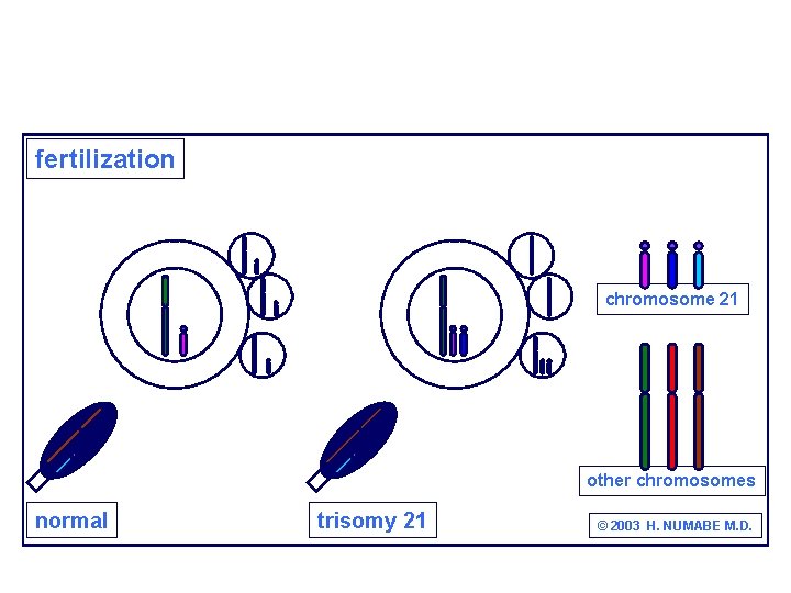 fertilization chromosome 21 other chromosomes normal trisomy 21 © 2003 H. NUMABE M. D.