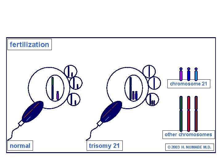 fertilization chromosome 21 other chromosomes normal trisomy 21 © 2003 H. NUMABE M. D.