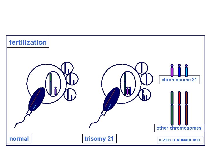 fertilization chromosome 21 other chromosomes normal trisomy 21 © 2003 H. NUMABE M. D.