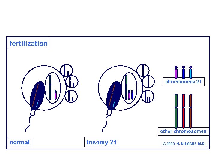 fertilization chromosome 21 other chromosomes normal trisomy 21 © 2003 H. NUMABE M. D.