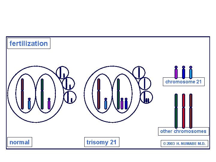 fertilization chromosome 21 other chromosomes normal trisomy 21 © 2003 H. NUMABE M. D.