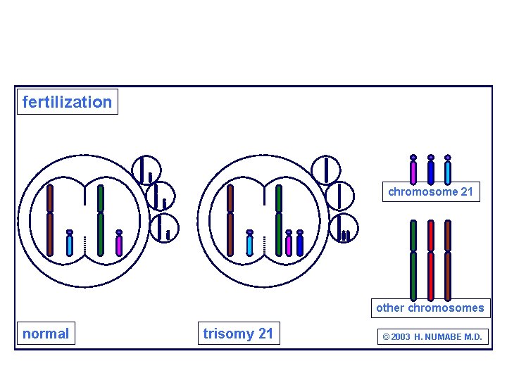 fertilization chromosome 21 other chromosomes normal trisomy 21 © 2003 H. NUMABE M. D.