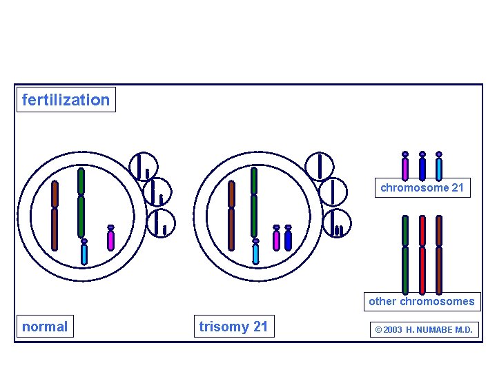 fertilization chromosome 21 other chromosomes normal trisomy 21 © 2003 H. NUMABE M. D.