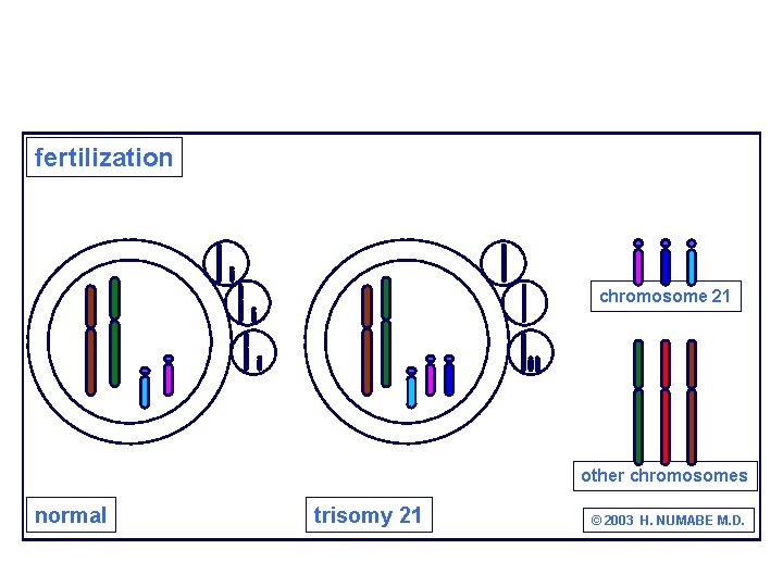 fertilization chromosome 21 other chromosomes normal trisomy 21 © 2003 H. NUMABE M. D.