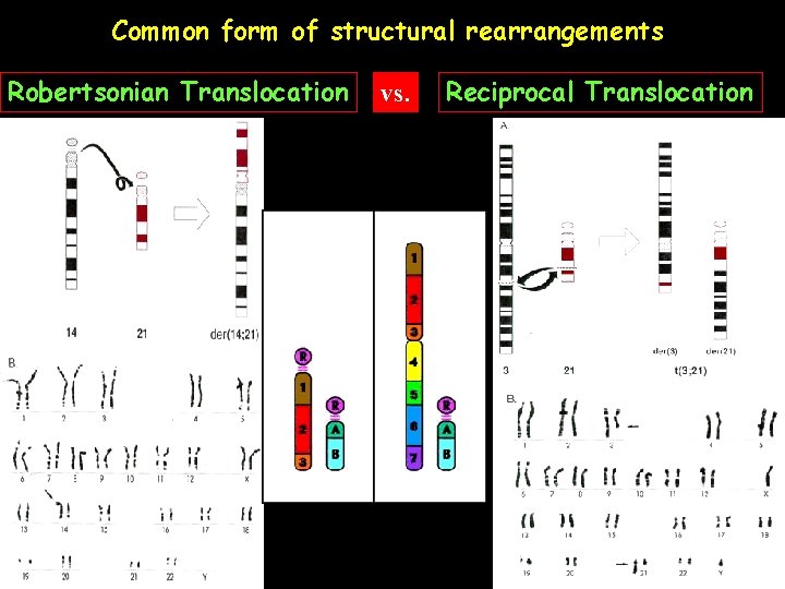 Common form of structural rearrangements Robertsonian Translocation vs. Reciprocal Translocation 