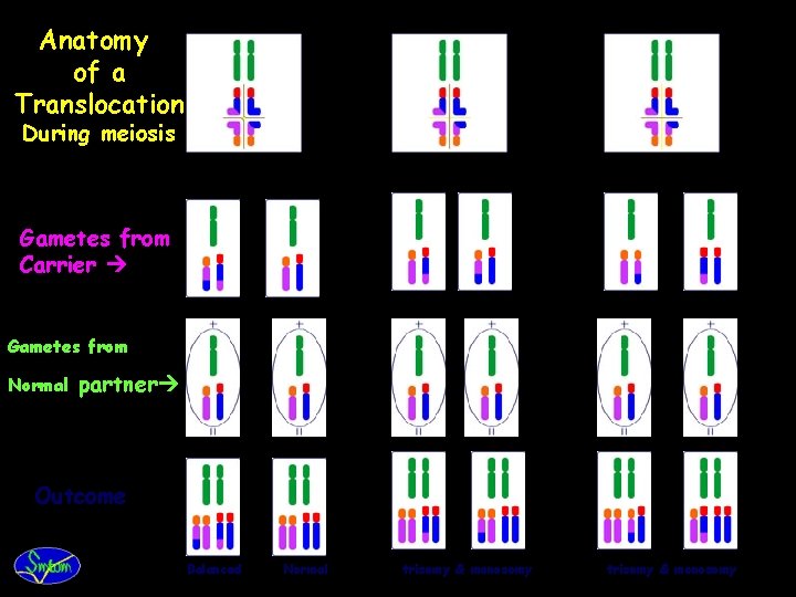 Anatomy of a Translocation During meiosis Gametes from Carrier Gametes from Normal partner Outcome