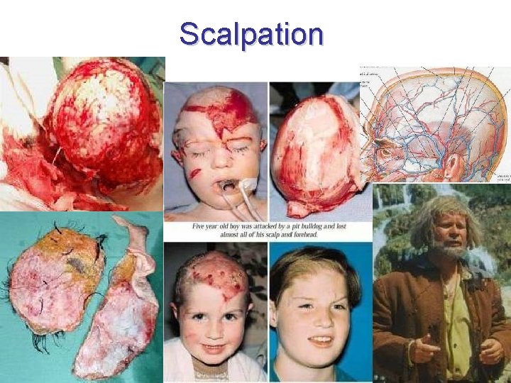 Scalpation 