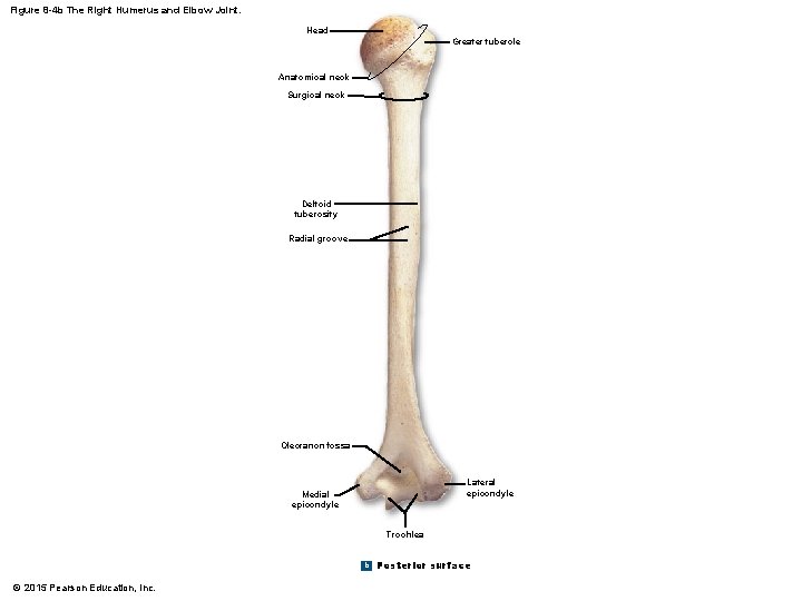 Figure 8 -4 b The Right Humerus and Elbow Joint. Head Greater tubercle Anatomical