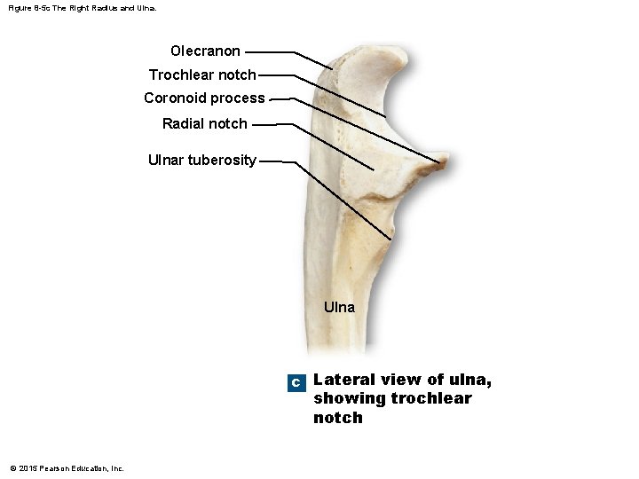 Figure 8 -5 c The Right Radius and Ulna. Olecranon Trochlear notch Coronoid process