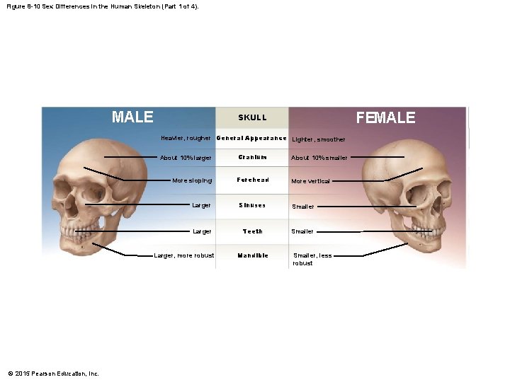 Figure 8 -10 Sex Differences in the Human Skeleton (Part 1 of 4). MALE