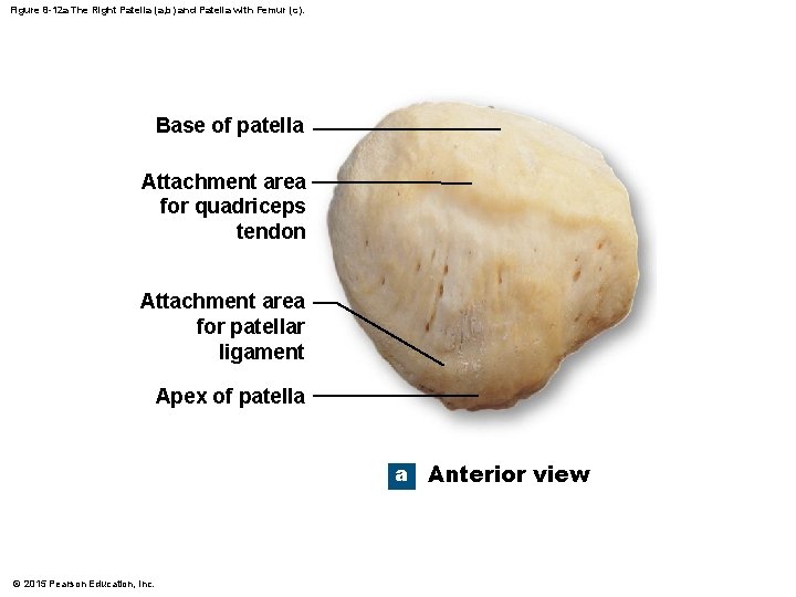 Figure 8 -12 a The Right Patella (a, b) and Patella with Femur (c).