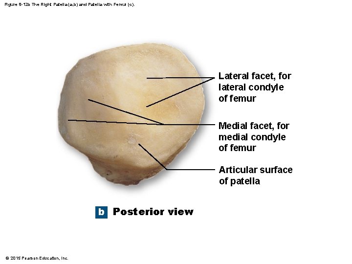 Figure 8 -12 b The Right Patella (a, b) and Patella with Femur (c).