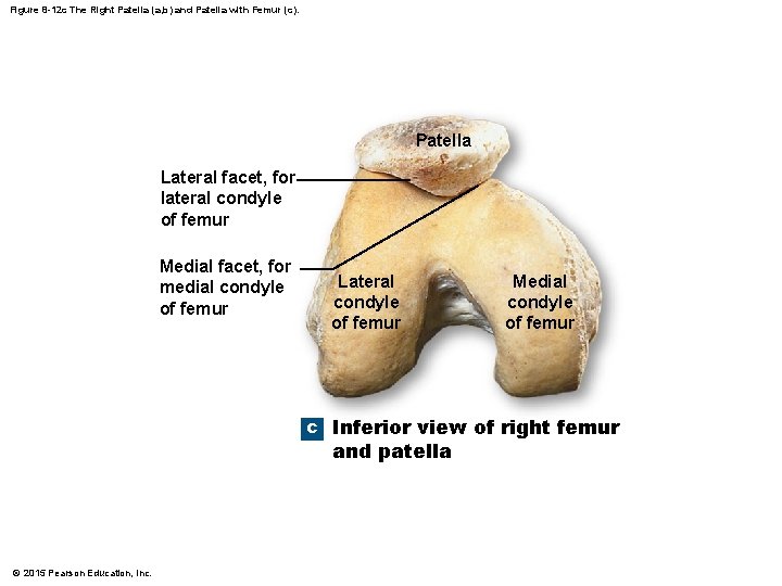 Figure 8 -12 c The Right Patella (a, b) and Patella with Femur (c).