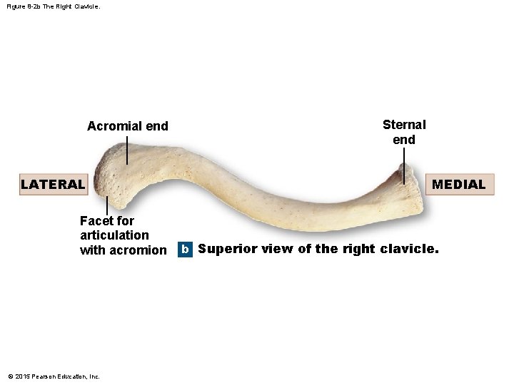 Figure 8 -2 b The Right Clavicle. Acromial end LATERAL Facet for articulation with