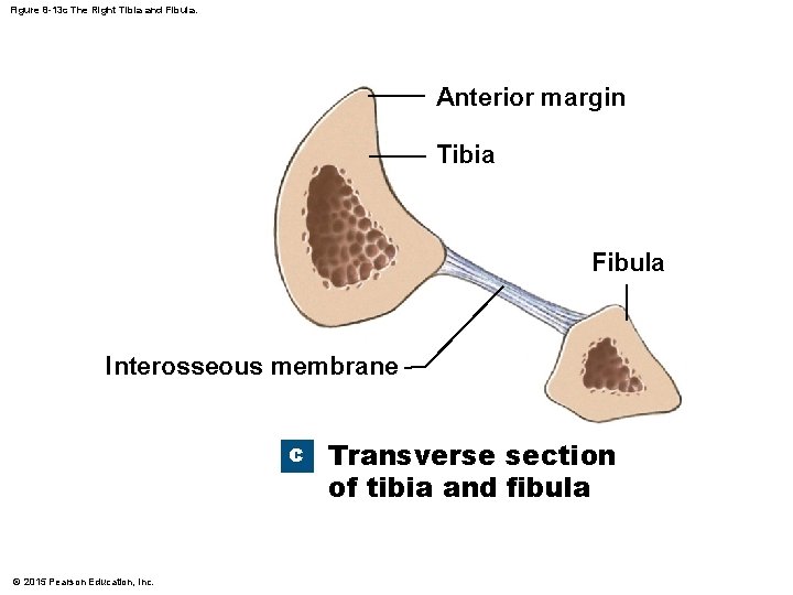 Figure 8 -13 c The Right Tibia and Fibula. Anterior margin Tibia Fibula Interosseous