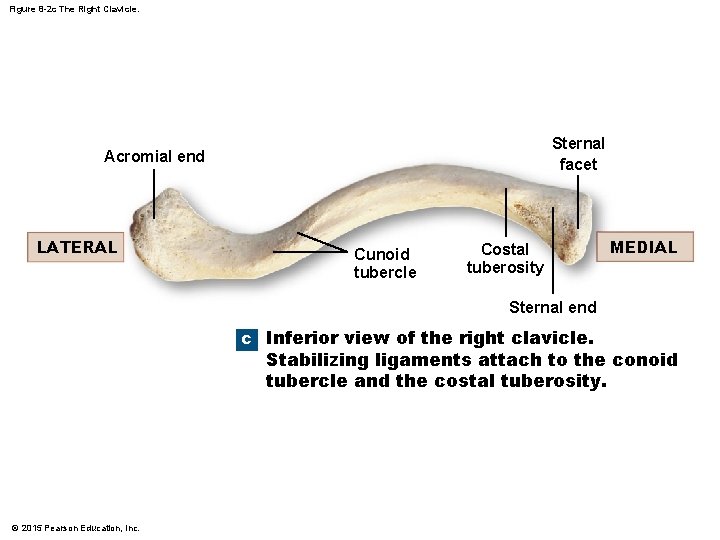 Figure 8 -2 c The Right Clavicle. Sternal facet Acromial end LATERAL Cunoid tubercle