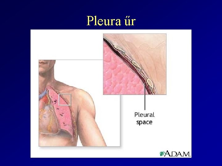 Pleura űr 