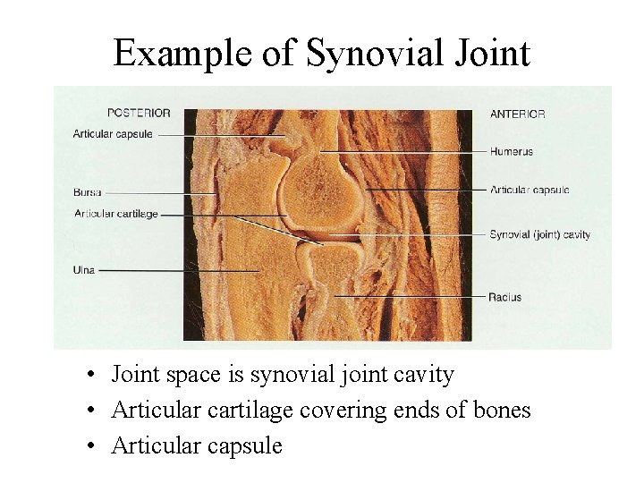 Example of Synovial Joint • Joint space is synovial joint cavity • Articular cartilage
